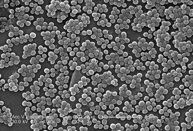 File:Mrsa.jpg
