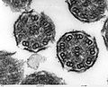 Cross-sectioned lung cilia.