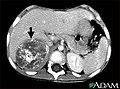 Thumbnail for version as of 01:12, 18 November 2011