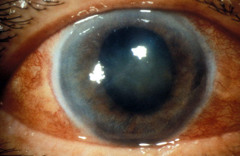 File:5703132843 9c1c202d26 o.jpg