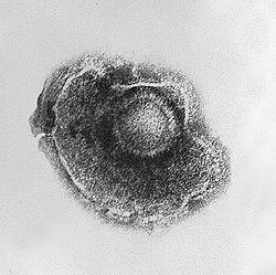 Virus.jpg