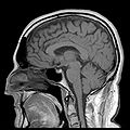 Thumbnail for version as of 07:18, 12 May 2010