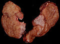 Thumbnail for version as of 09:55, 12 May 2010