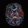 Thumbnail for version as of 02:40, 16 December 2010