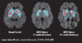 Thumbnail for version as of 00:56, 18 February 2011