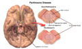 Thumbnail for version as of 16:13, 27 January 2015
