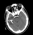 Thumbnail for version as of 14:43, 18 February 2011