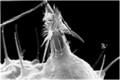 Nematocyst.