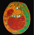 Thumbnail for version as of 15:02, 21 April 2008