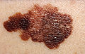 Thumbnail for version as of 18:32, 18 May 2009