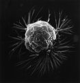 A Metastasizing Breast Cancer Cell
