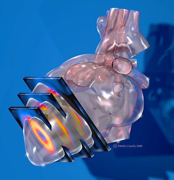 File:Heart spect imaging.jpg