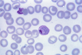 Plasmodium (Plasmodium vivax)