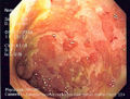 Thumbnail for version as of 05:34, 13 March 2017