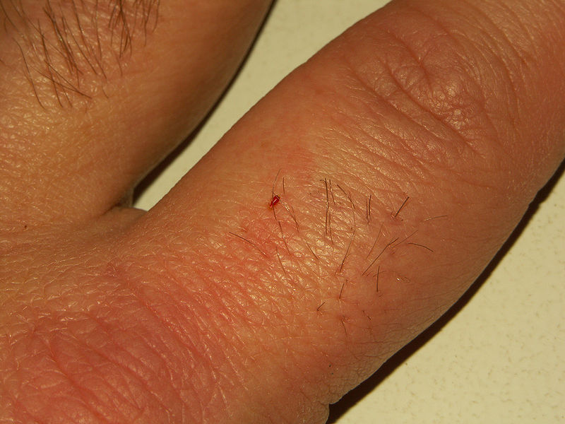 File:Bedbug feeding.jpg