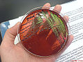 Escherichia coli