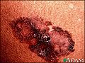 Thumbnail for version as of 05:04, 4 January 2010
