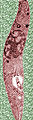 Brucei (Trypanosoma brucei)
