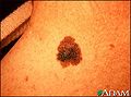 Thumbnail for version as of 00:52, 4 January 2010