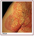 Thumbnail for version as of 03:38, 6 March 2009