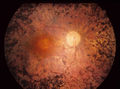 Thumbnail for version as of 20:30, 25 October 2014