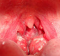 Thumbnail for version as of 08:38, 8 March 2010