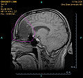 Thumbnail for version as of 02:49, 14 January 2009