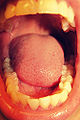 Thumbnail for version as of 03:14, 4 January 2010