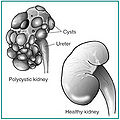Thumbnail for version as of 16:31, 8 December 2010