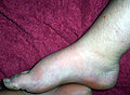 Thumbnail for version as of 13:09, 15 March 2011