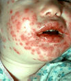 Thumbnail for version as of 03:22, 10 June 2013