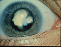 Thumbnail for version as of 04:31, 12 May 2010