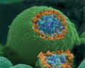 A scanning electron microscope picture of a nerve ending broken open to reveal vesicles (orange and blue) containing Neurotransmitters.