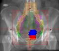 Thumbnail for version as of 04:03, 7 November 2013