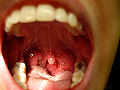Thumbnail for version as of 20:39, 27 April 2008