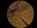 Escherichia coli