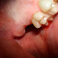 Thumbnail for version as of 07:37, 22 January 2007