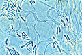 Thumbnail for version as of 04:22, 3 March 2009