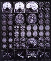Thumbnail for version as of 02:36, 16 November 2012