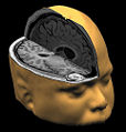 Digitalized Image of a Human Brain's Core