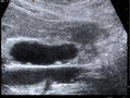 Thumbnail for version as of 05:54, 18 October 2016