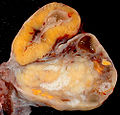 Thumbnail for version as of 04:48, 18 May 2009