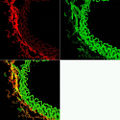 Thumbnail for version as of 22:43, 19 January 2009