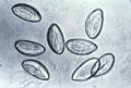 Thumbnail for version as of 17:56, 14 May 2007
