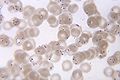 P. falciparum rings (Plasmodium falciparum)