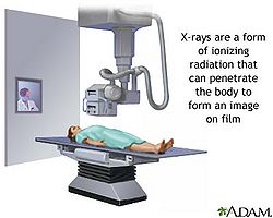 Xray.jpg