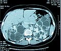 Thumbnail for version as of 05:21, 12 March 2009