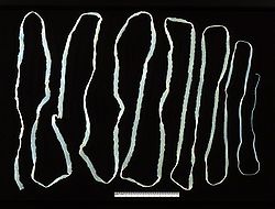 Extremly long tapeworm.jpg