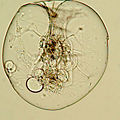 Rotifer (Asplanchna herricki) carnivorous