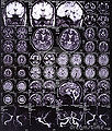 Thumbnail for version as of 02:38, 16 November 2012